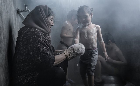 شکستن همزمان بیست استخوان